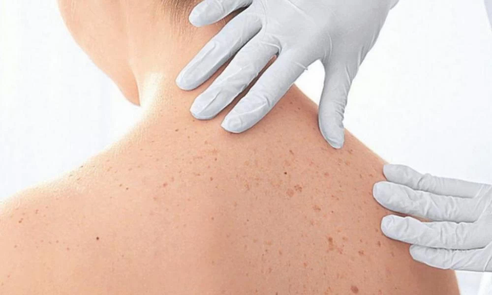 Ποια συμπτώματα δείχνουν ότι έχετε πρόβλημα στον θυρεοειδή